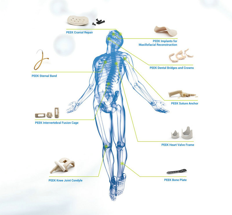 Medical Implant Material - PEEK (Polyether Ether Ketone)